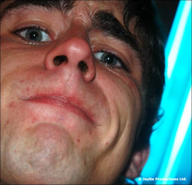 A close-up of a person's face from below, with a bright blue light at the side