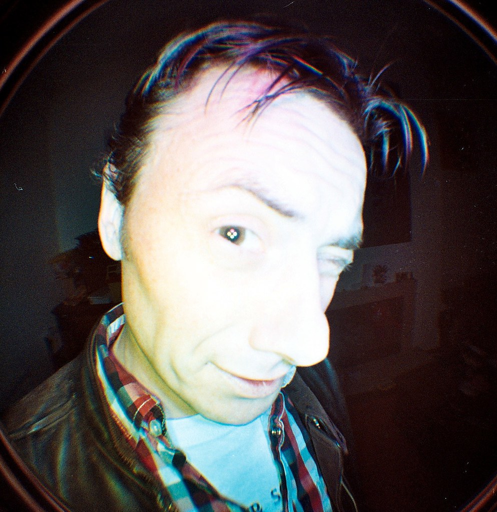 Ringflash